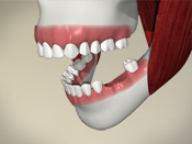 ID Dental - Missing Teeth - Introduction
