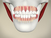 ID Dental - Ideal Alignment and Occlusion